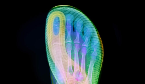 Die Toe Pilot-Technologie von Joe Nimble (Foto: Gustoimages Ltd, Hugh Turvey)